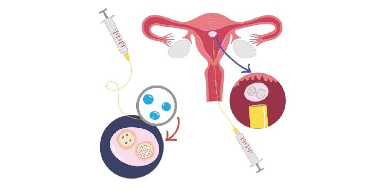 Ovulation Induction Mira Road Bhayandar